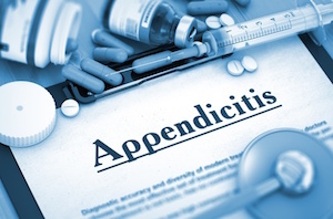 Appendicitis