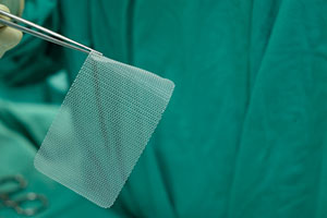 Bard Hernia Mesh