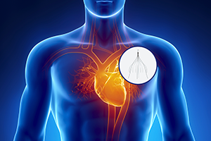 Cook IVC Filter