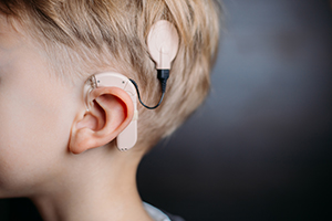 Defective Cochlear Implant