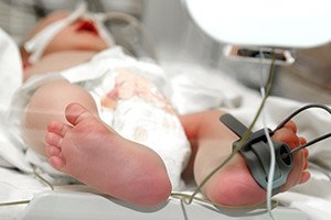 Nuchal Cord Injuries