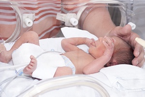 Preterm Birth, Prematurity, and Preemies