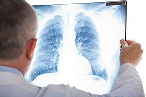 Pulmonary X-ray