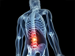 X-Ray backache